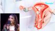 PCOS Decoded: After The Rebel Kid Apoorva Makheeja Was Slammed For Promoting PCOS Pills, Check Here