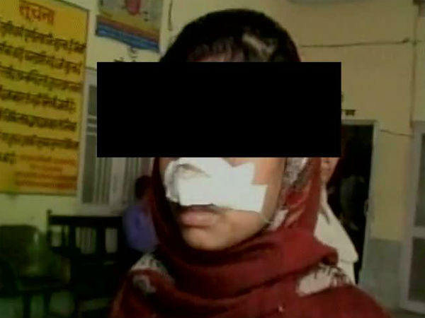 আক্রমণ আক্রমণ