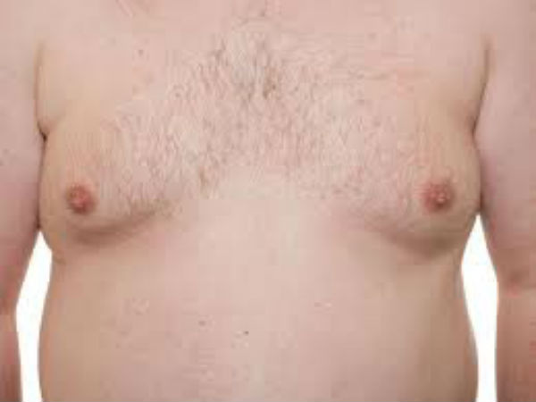 স্থূলত্ব