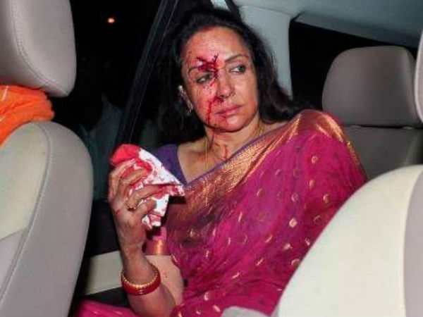 রক্তাক্ত হেমা মালিনী