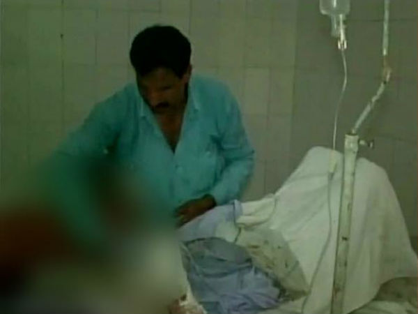 দগ্ধ মহিলা দগ্ধ মহিলা