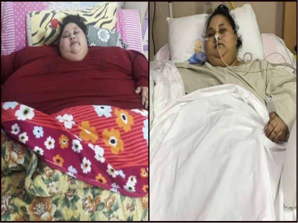 বিশ্বের সবচেয়ে ভারি মহিলা ইমান আহমেদ ২ মাসে ২৪২ কেজি ওজন কমিয়েছেন বিশ্বের সবচেয়ে ভারি মহিলা ইমান আহমেদ ২ মাসে ২৪২ কেজি ওজন কমিয়েছেন
