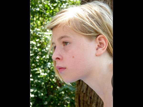 গালে তিল 