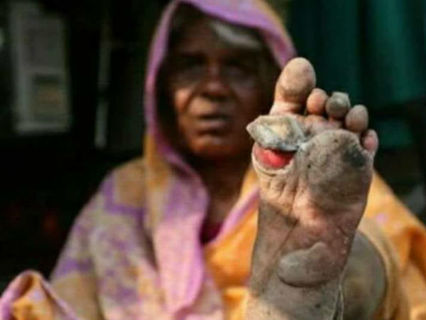  ওড়িশায় কৃষক অসন্তোষ 