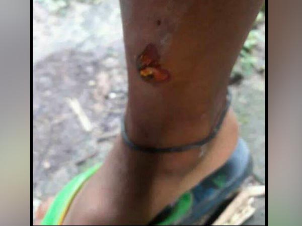 ১০ টাকার জন্য অমানবিক নির্যাতন শিশুকে, গরম খুন্তির ছ্যাঁকা