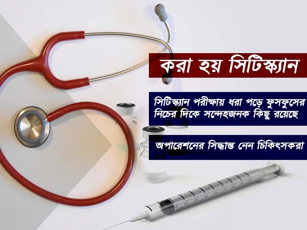 করা হয় সিটিস্ক্যান