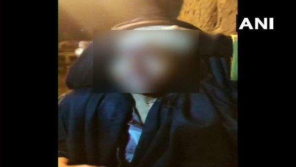 আহত হয়েছেন এক অধ্যাপিকাও