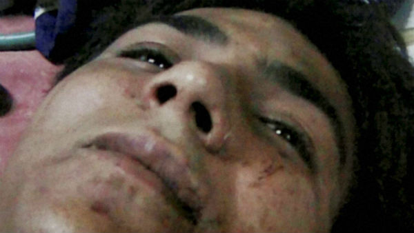 পাকিস্তান মরিয়া চেষ্টা করেছিল কাসাভকে খাতা থেকে মুছে দিতে..