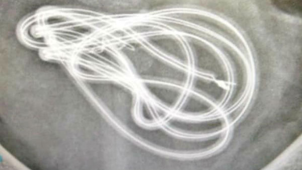  কী বলছেন সার্জনরা?