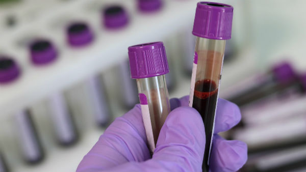 মানুষ থেকে প্রাণীতে সংক্রমণ হয়নি