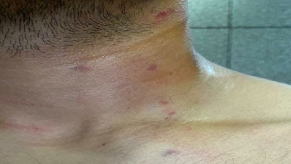 পুলিশি নিষ্ক্রিয়তার অভিযোগ