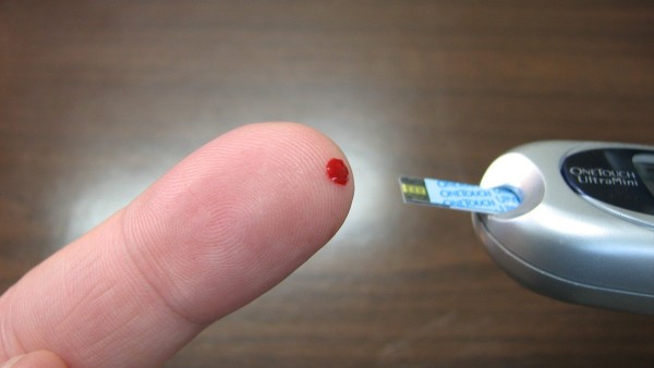 ঠাণ্ডা ভাতে প্রতিরোধী স্টার্চ ঠাণ্ডা ভাতে প্রতিরোধী স্টার্চ