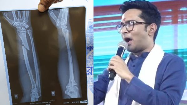হাসপাতালে যাচ্ছেন অভিষেক হাসপাতালে যাচ্ছেন অভিষেক