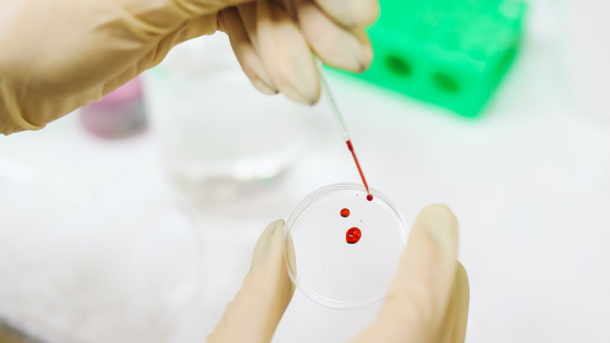 Image of blood test Image of blood test