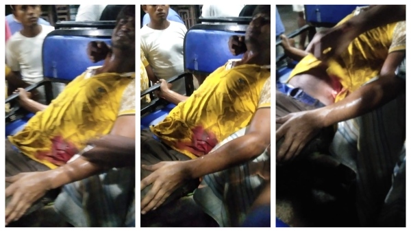 তৃণমূল বিধায়কের সামনেই গুলি কংগ্রেস কর্মীকে তৃণমূল বিধায়কের সামনেই গুলি কংগ্রেস কর্মীকে