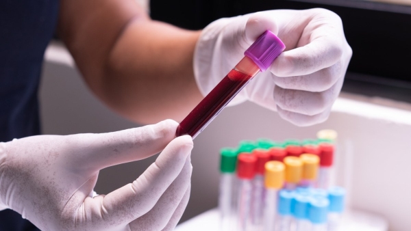image of blood test