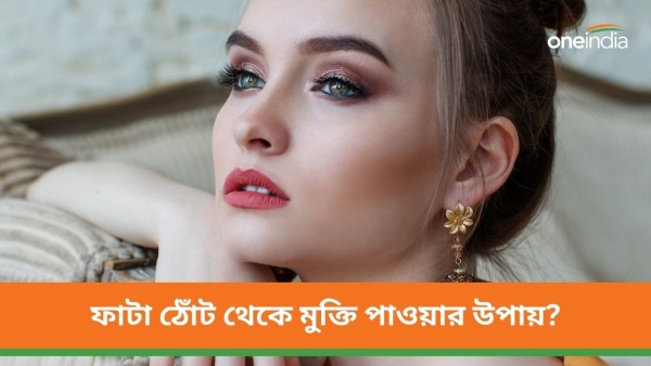 Winter Beauty Care Winter Beauty Care