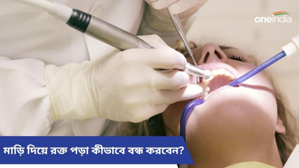 teeth problem teeth problem