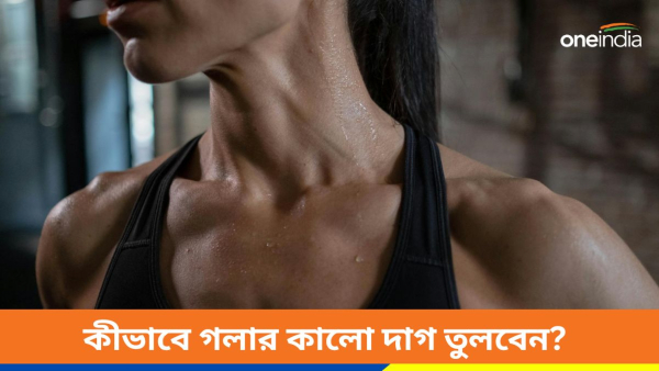 neck