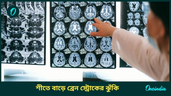Brain
