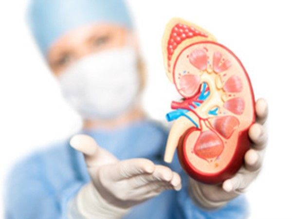 दिल्लीः मरीज की किडनी से निकले 856 स्टोन, डॉक्टर हुए हैरान