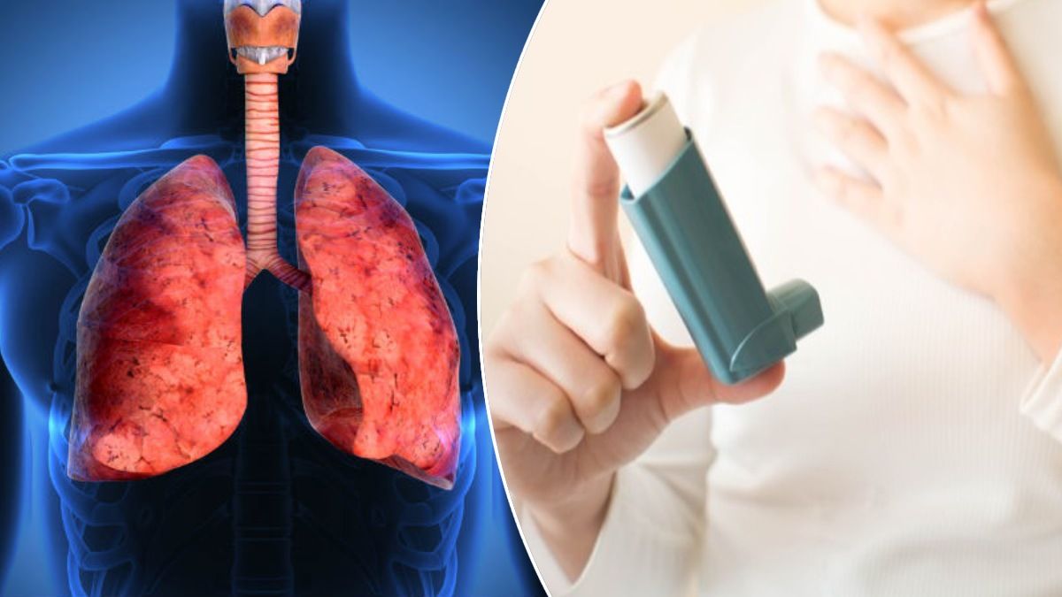 Asthma: सर्दियों में अस्थमा, जानें कैसे है बचना!