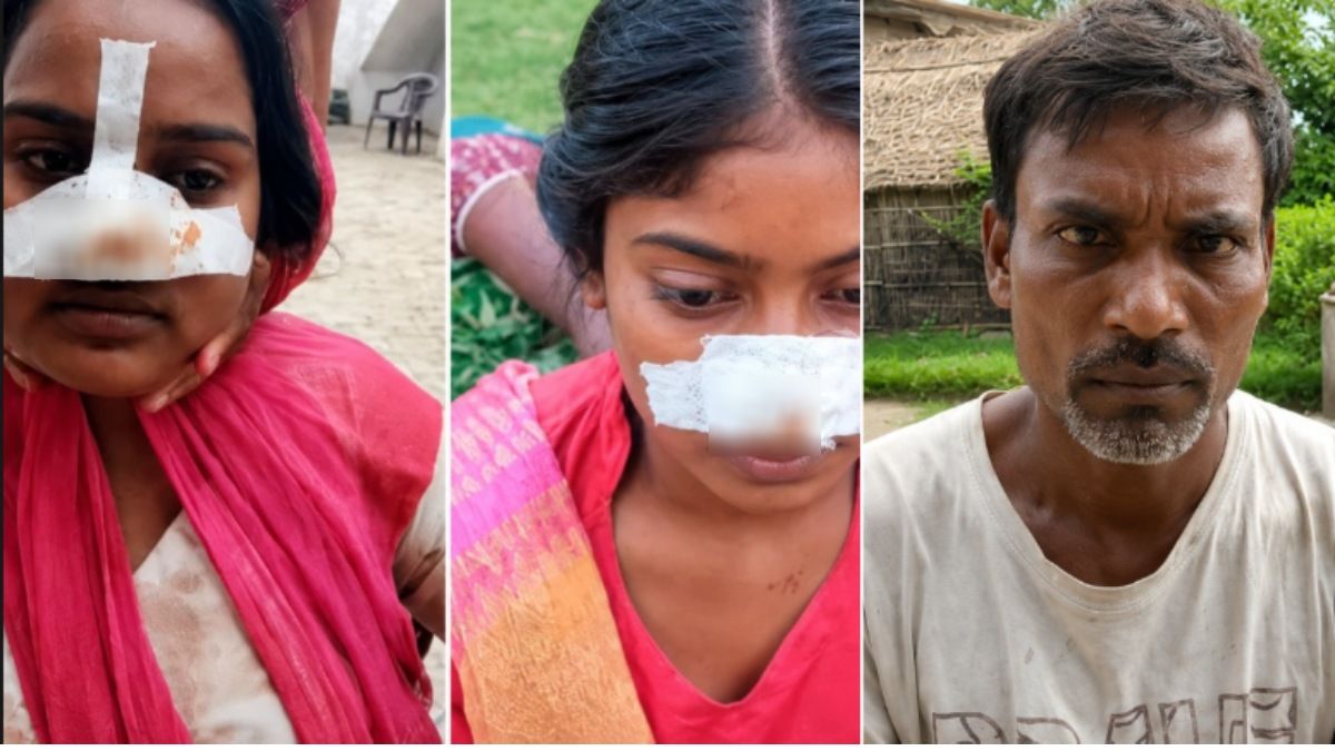 पति ने दांतों से काटी पत्नी की नाक, सास ने भी दामाद की बहन को बनाया 'शूर्पणखा', 4 साल की शादी का खौफनाक रूप