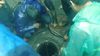 Mumbai Man Missing After Falling Into Open Manhole During Heavy Rain, Massive Rescue Operation On Mumbai Man Missing After Falling Into Open Manhole During Heavy Rain, Massive Rescue Operation On