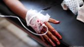 Gaza Officials Say Several Killed In Israeli Strike