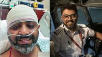 இரண்டாக பிளந்த மண்டையோடு.. இந்திய பைலட்டின் மூளை பாதிக்க வாய்ப்பு - அவசர ஆபரேஷனின் ஷாக் பின்னணி