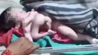 Viral Video: 4 కాళ్లు, 4 చేతులతో వింత శిశువు జననం.. చూసేందుకు ఎగబడుతున్న ప్రజలు..