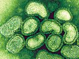 India prepared to face Swine flu