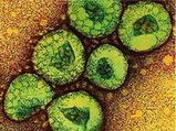 What is Middle East Respiratory Syndrome coronavirus (MERS)?: Explained