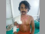 Second attack in a year on Dalit priest in Kerala