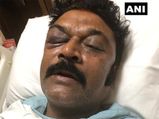 Karnataka resort brawl: Congress suspends MLA JN Ganesh for assaulting fellow MLA Anand Singh