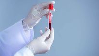Less COVID-19 cases in last three days in Madhya Pradesh