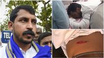 Bhim Army Chief Chandrashekhar Azad Ravan Shot At In UP's Saharanpur