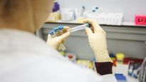 Lab Test Charges To Be Regulated: Govt Enforces Pricing Rules, Flying Squads To Monitor Labs