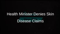 UP Health Minister Brajesh Pathak Refutes Skin Disease Claims After Sangam Bathing