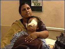 पाक में लड़कियों पर तेज़ाब फेंका गया