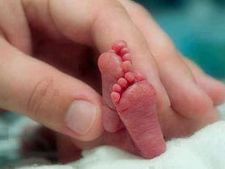 पाकिस्‍तान में जन्‍मा छह पैर वाला अजूबा बच्‍चा 