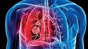 Tuberculosis: क्या जानलेवा टीबी से मुक्त हो पायेगी दुनिया?