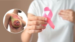 Breast Cancer: जर्मन मॉडल का स्तन कैंसर से निधन, जानिए कितनी गंभीर है यह बीमारी?