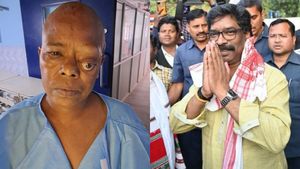 CM Hemant Soren के निर्देश पर रिम्स में हुआ जटिल ऑपरेशन, ट्यूमर की वजह से आंख निकल आई थी बाहर