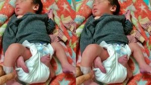 AJAB-GAZAB: 4 हाथ और 4 पैर के साथ हुआ बच्चे का जन्म, नवजात के इलाज के लिए चिंतित परिवार