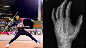 Diamond League: फाइनल में नीरज चोपड़ा के कौन से हाथ में था फ्रेक्चर? खुद तस्वीर शेयर कर दी जानकारी