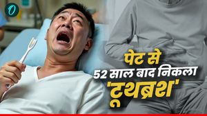 Bizarre News: 12 की उम्र में निगला था 'टूथब्रश’, डॉक्टर्स ने 52 साल बाद पेट से निकाला, आंत के पास चिपका रहा