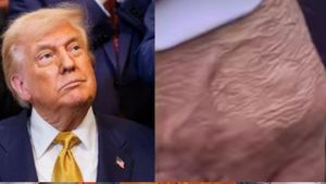 Donald Trump: अमेरिकी राष्ट्रपति ट्रंप को क्या हुआ? इस बीमारी को लेकर बढ़ी चिंता, जानिए कितनी खतरनाक है ये
