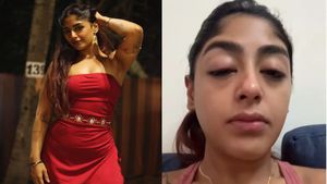 'चेहरा बिगाड़ा, दांत तोड़ दिया', मुंबई क्लब में Splitsvilla 16 की महिला कंटेस्टेंट को खूब पीटा, क्या हुई बात?