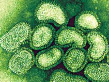India prepared to face Swine flu